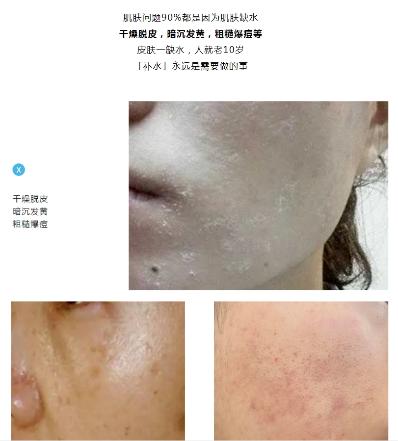 面膜爆品 | 令人艷羨的好皮膚，全靠「補(bǔ)水」